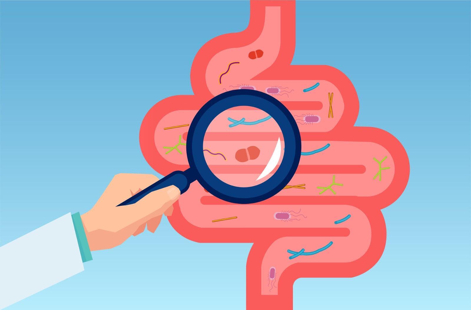 Leaky Gut - wie man sich vor einem durchlässigen Darm schützen kann